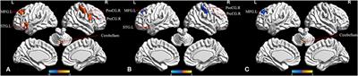 Functional Integrity of Executive Control Network Contributed to Retained Executive Abilities in Mild Cognitive Impairment